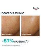 Eucerin Хидратиращ крем за лице DermoPure 40 мл