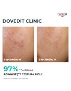 Eucerin Нощна ексфолираща терапия DermoPure 40 мл
