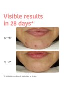 Iroha Тъканна маска с гликолова киселина Glow Peeling 23 мл