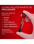 L'Oreal Paris Коригиращ крем за зоната около очите Revitalift Laser Намалява тъмните кръгове и изглажда бръчките 15 мл