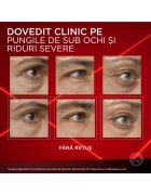 L'Oreal Paris Коригиращ крем за зоната около очите Revitalift Laser Намалява тъмните кръгове и изглажда бръчките 15 мл
