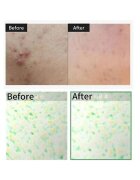 VT Cosmetics Тоник за грижа за кожата CicaXHyalon Reedle Shot 100 50 мл