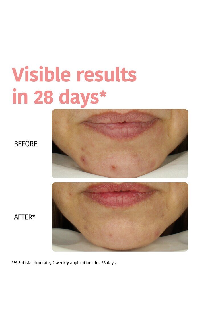 Iroha Тъканна маска с гликолова киселина Glow Peeling 23 мл