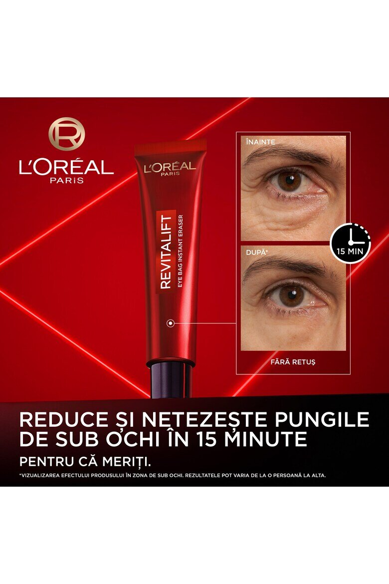 L'Oreal Paris Коригиращ крем за зоната около очите Revitalift Laser Намалява тъмните кръгове и изглажда бръчките 15 мл