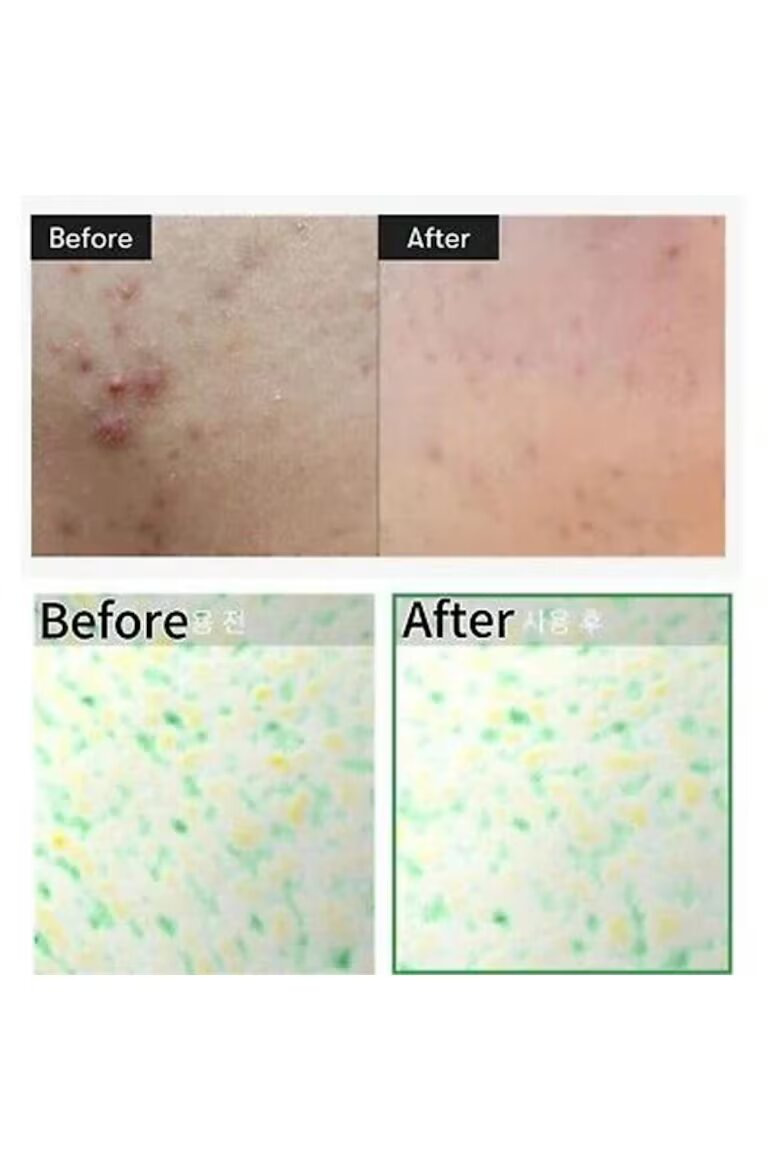 VT Cosmetics Тоник за грижа за кожата CicaXHyalon Reedle Shot 100 50 мл